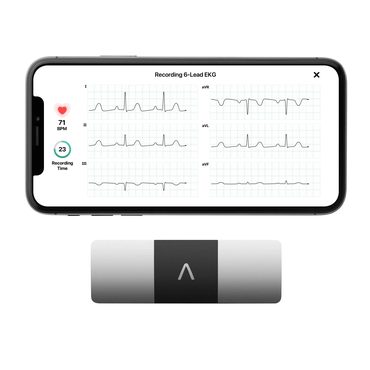 Durable Standard Goods KardiaMobile 6L Personal EKG Monitor with Most Smartphones Fine